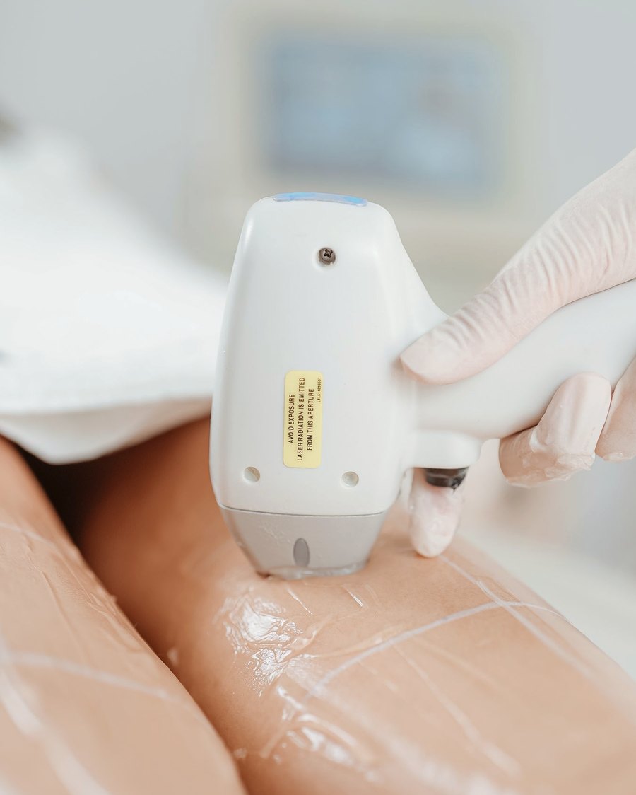 Aplicação de laser em clínica de estética