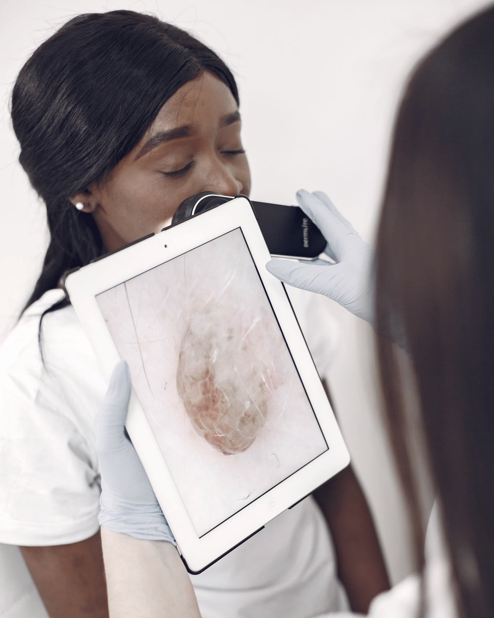 Consulta dermatológica com avaliação da pele
