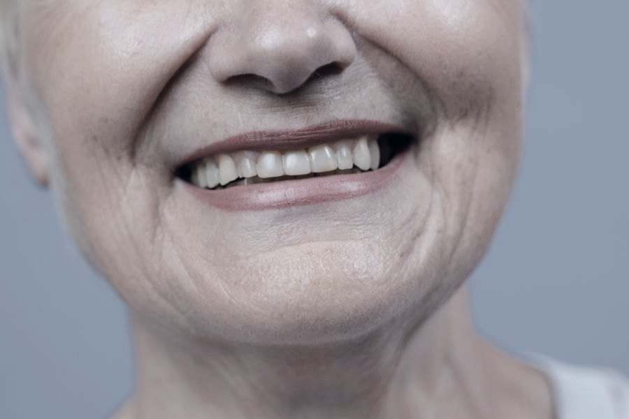 Senhora sorrindo após reabilitação oral